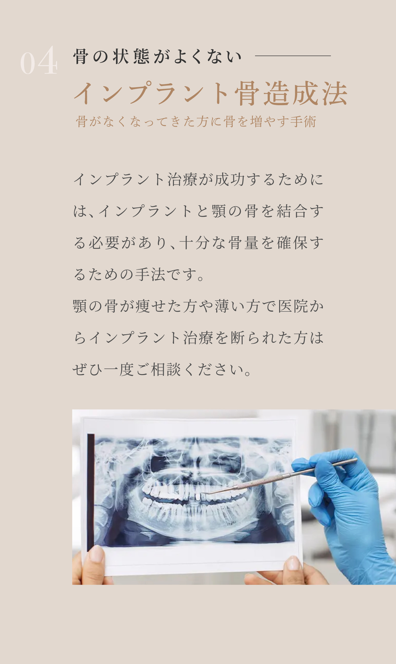 04 骨の状態がよくない インプラント骨造成法 骨がなくなってきた方に骨を増やす手術 インプラント治療が成功するためには、インプラントと顎の骨を結合する必要があり、十分な骨量を確保するための手法です。顎の骨が痩せた方や薄い方で医院からインプラント治療を断られた方はぜひ一度ご相談ください。